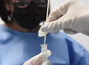 nova-variante-do-virus-da-covid-19-circula-na-cidade-do-rio-de-janeiro