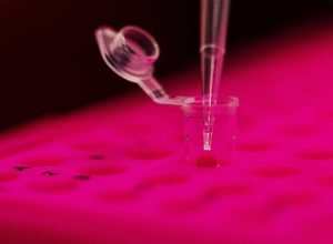 mapeamento-genetico-identifica-risco-hereditario-de-cancer-de-mama-em-ate-10%-dos-casos